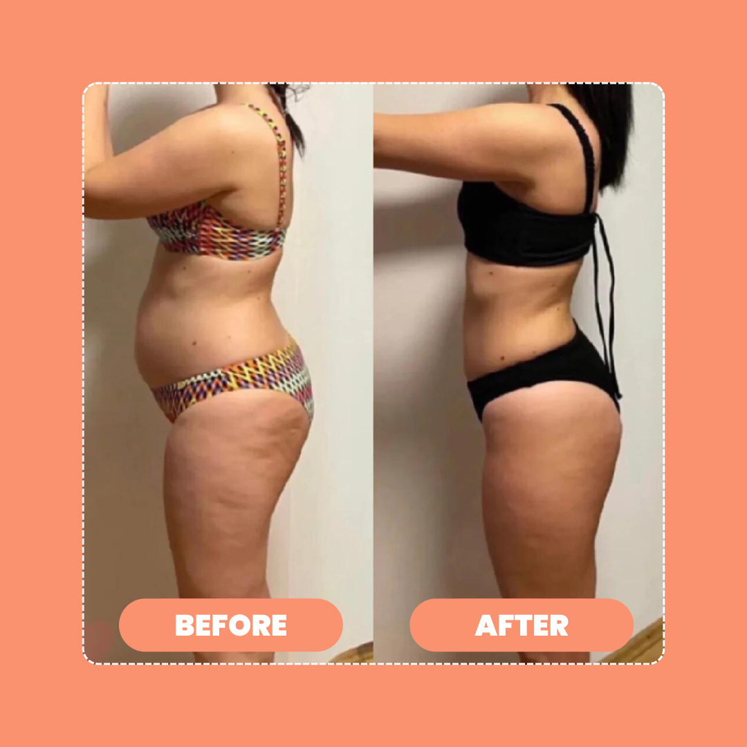 Pulzen™ Body Sculpting Device